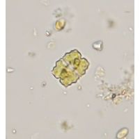 Eurastrum denticulatum