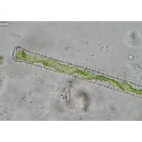 Gonatozygon aculeatum