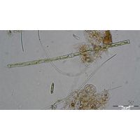 Gonatozygon aculeatum