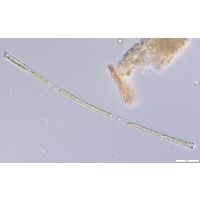 Gonatozygon aculeatum