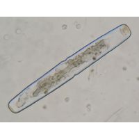 Haplotaenium minutum
