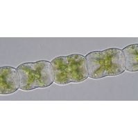 Hyalotheca