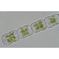 Hyalotheca