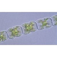 Hyalotheca