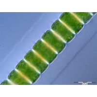 Hyalotheca dissiliens