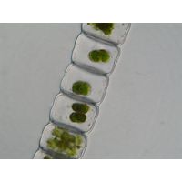 Hyalotheca dissiliens