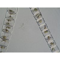 Hyalotheca dissiliens