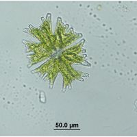 Micrasterias americana