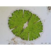 Micrasterias denticulata