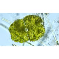 Micrasterias jenneri