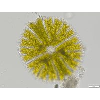 Micrasterias papillifera