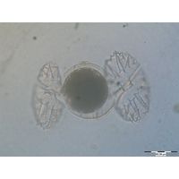 Micrasterias papilifera