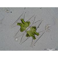 Micrasterias pinnatifida