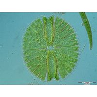 Micrasterias rotata