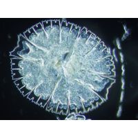 Micrasterias rotata