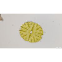 Micrasterias thomasiana