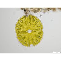 Micrasterias thomasiana