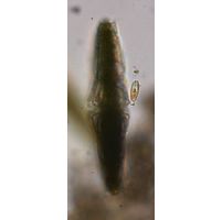 Micrasterias thomasiana