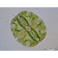 Micrasterias truncata