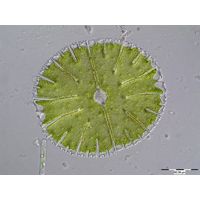 Micrasterias thomasiana