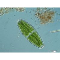 Netrium digitus