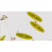 Netrium digitus