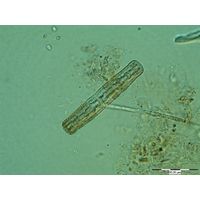 Penium exiquum