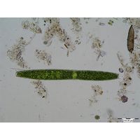 Pleurotaenium crenulatum