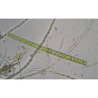 Pleurotaenium ehrenbergii