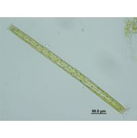 Pleurotaenium ehrenbergii