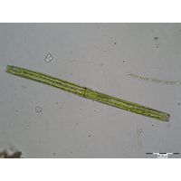 Pleurotaenium ehrenbergii