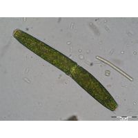 Pleurotaenium trabercula
