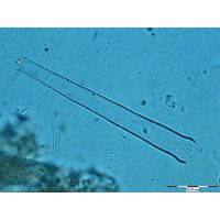 Pleurotaenium tridentulum