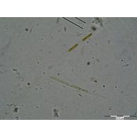 Roya pseudoclosterium