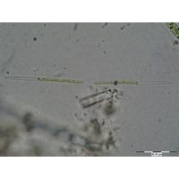 roya-pseudoclosterium-deleni