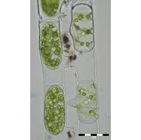 Spirogyra