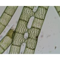 Spirogyra