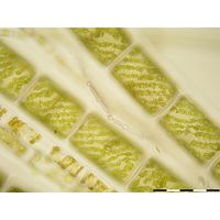 Spirogyra