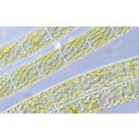 Spirogyra