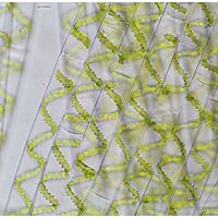 Spirogyra