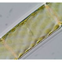 Spirogyra
