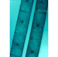 Spirogyra