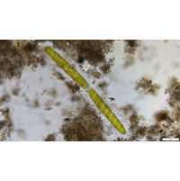 Spirotaenia condensata