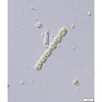 Spondylosium pulchellum