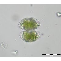 Staurastrum hirsutum