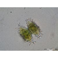 Staurastrum aculeatum
