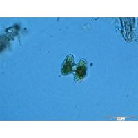Staurastrum alternans