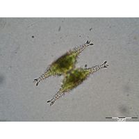 Staurastrum anatinum