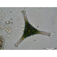 Staurastrum anatinum