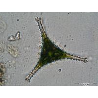 Staurastrum anatinum